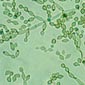 cladosporium-sp-3