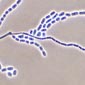 geotrichum