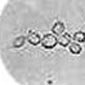 yeasts-teliomycetes