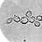 yeasts-teliomycetes